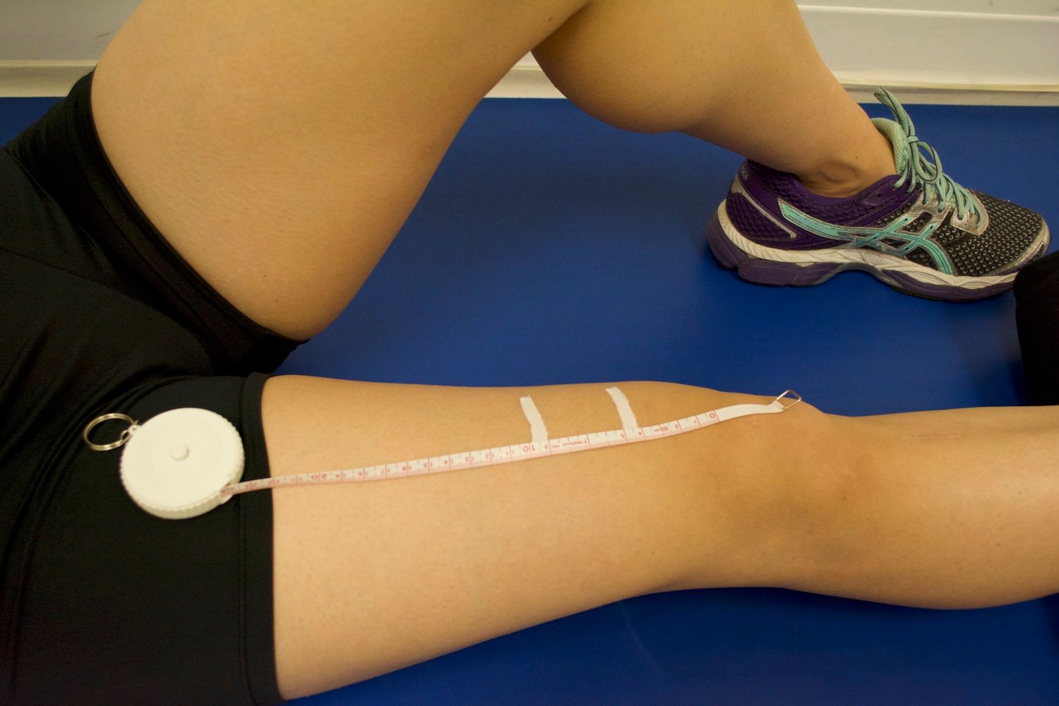 Here is a close up image showing adhesive tape marking the 5cm and 10cm above the knee cap, where circumference will be measured.