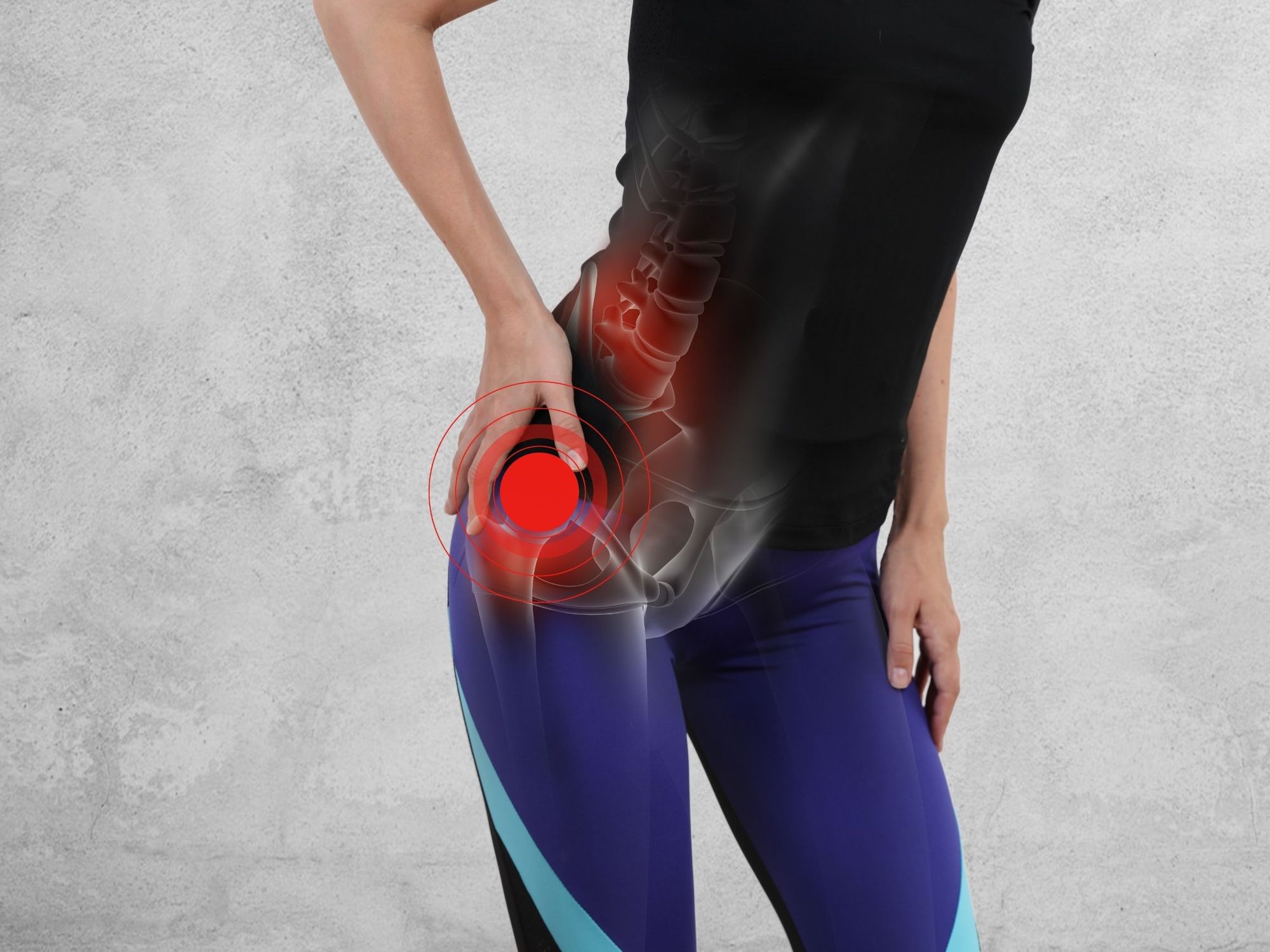 What To Expect After Total Hip Replacement Surgery
