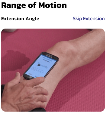 Should I Measure My Knee Bending and Straightening With My Phone
